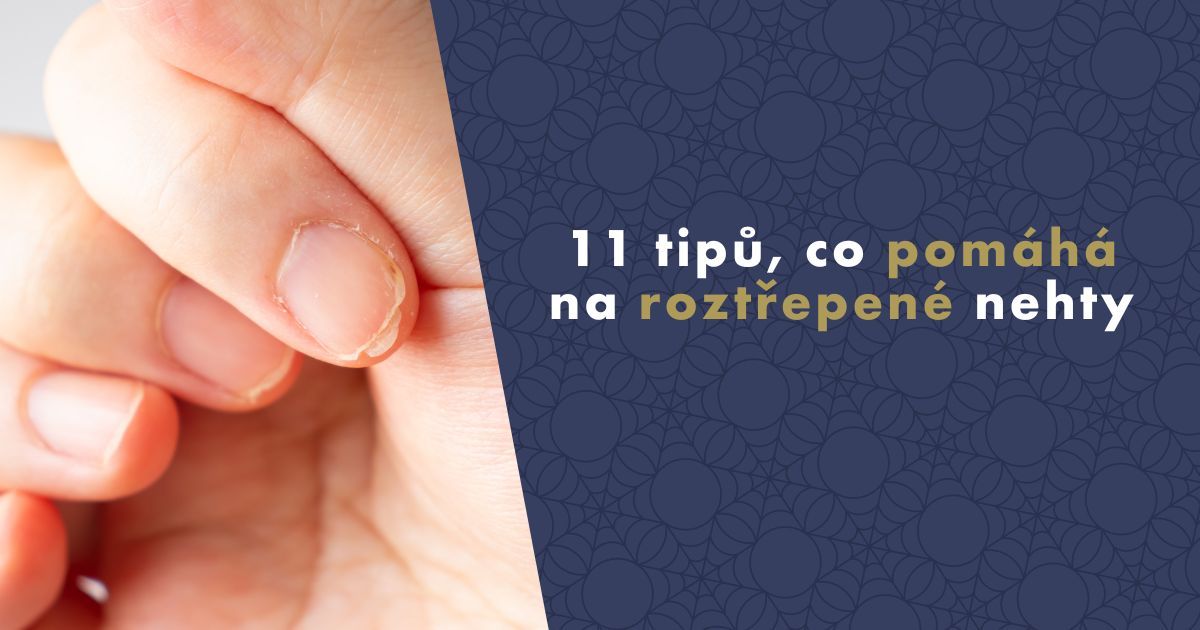 co-pomaha-na-roztrepene-nehty (1)